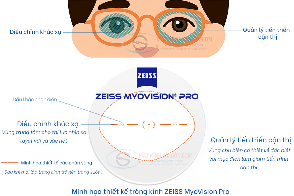 TRÒNG KÍNH 1.56 ZEISS MYOVISION PRO - Hover