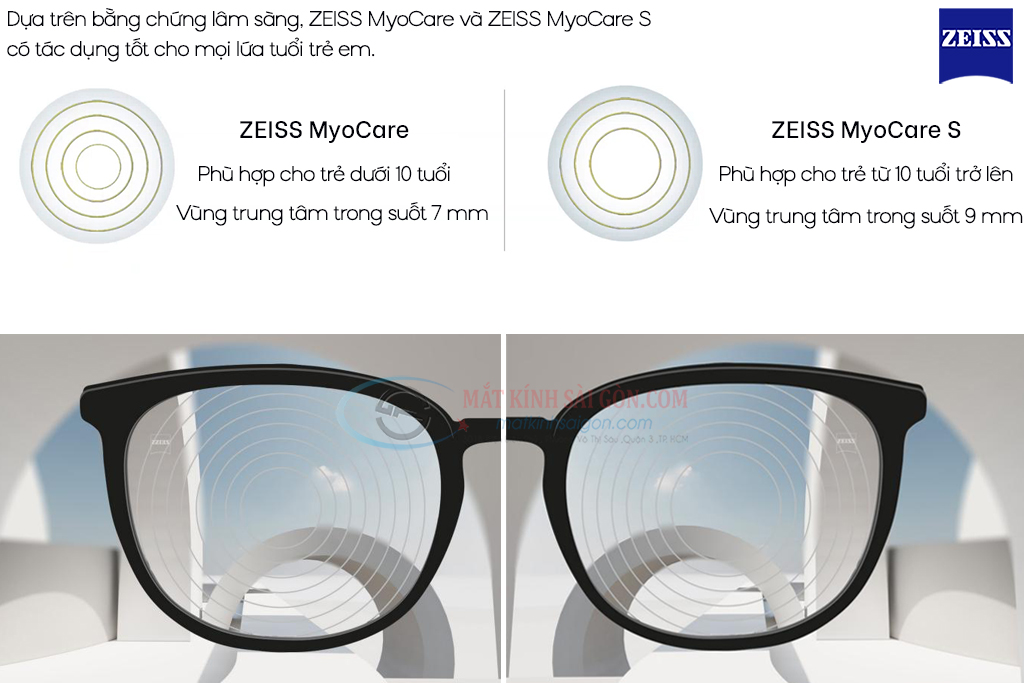 KÍNH KIỂM SOÁT CẬN THỊ ZEISS MYOCARE - Hình 4