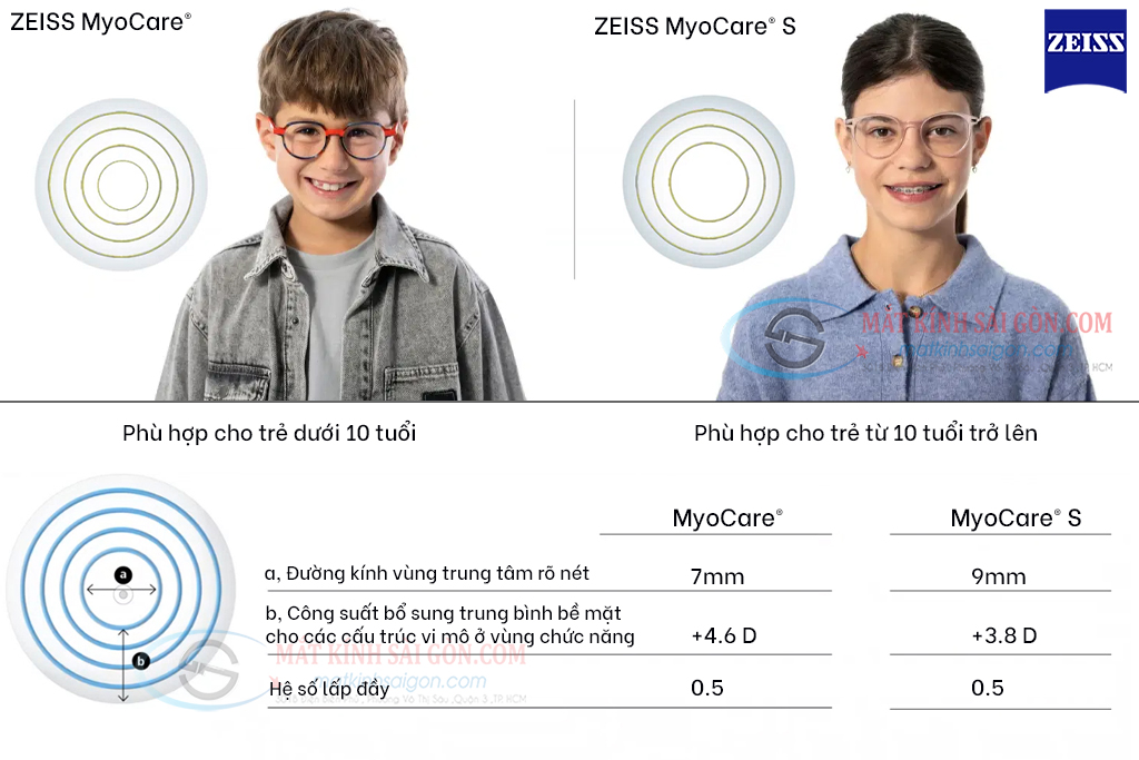 KÍNH KIỂM SOÁT CẬN THỊ ZEISS MYOCARE - Hình 3